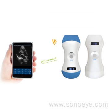 Wifi Probe ultrasound scanner